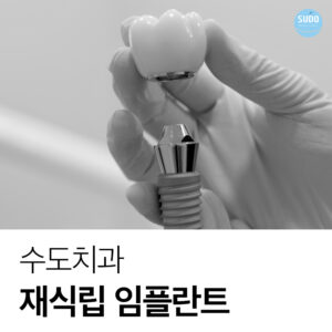 수도치과 임플란트