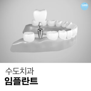 수도치과 임플란트