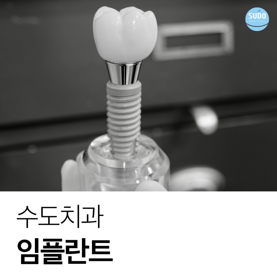 수도치과 임플란트