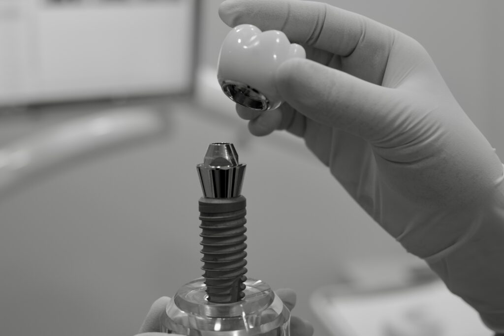 수도치과 임플란트