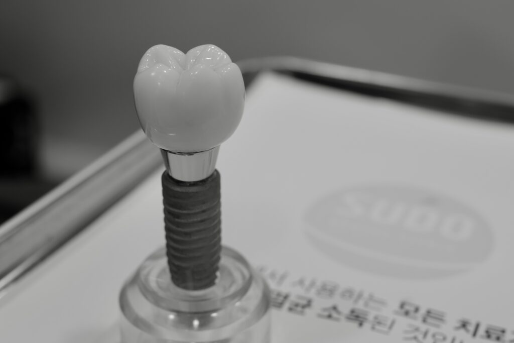 수도치과 임플란트