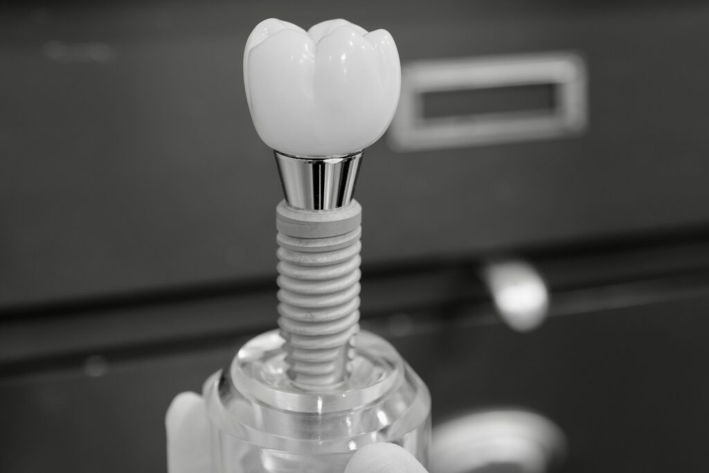 수도치과 임플란트