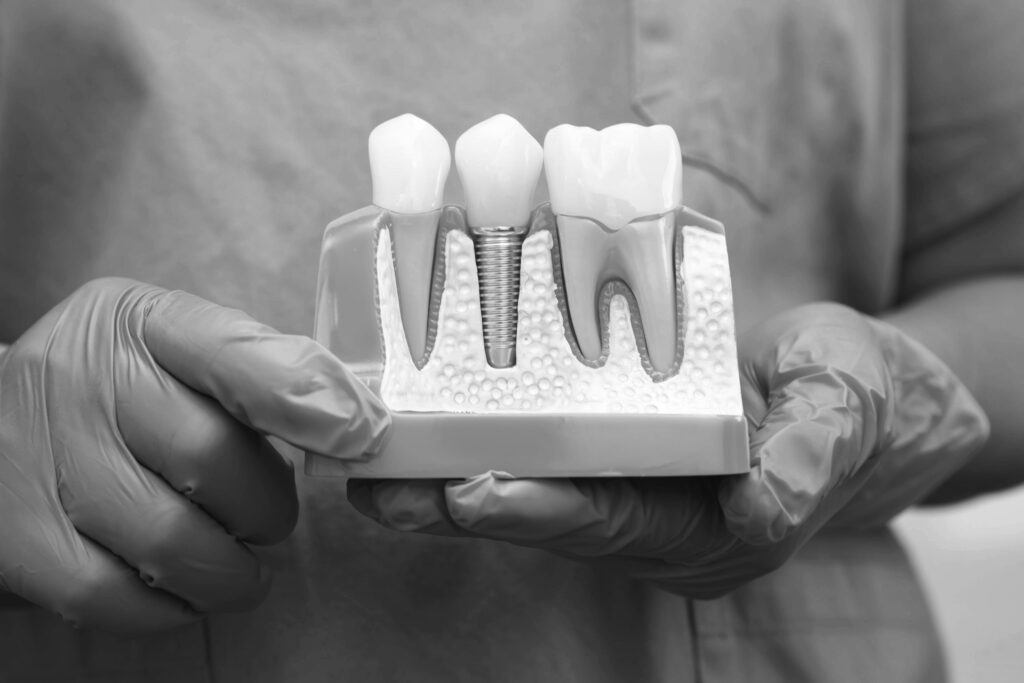 수도치과 임플란트