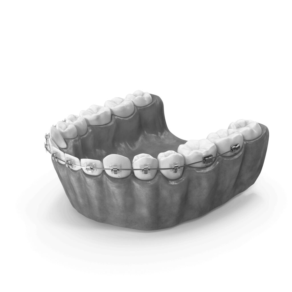 수도치과 치아교정