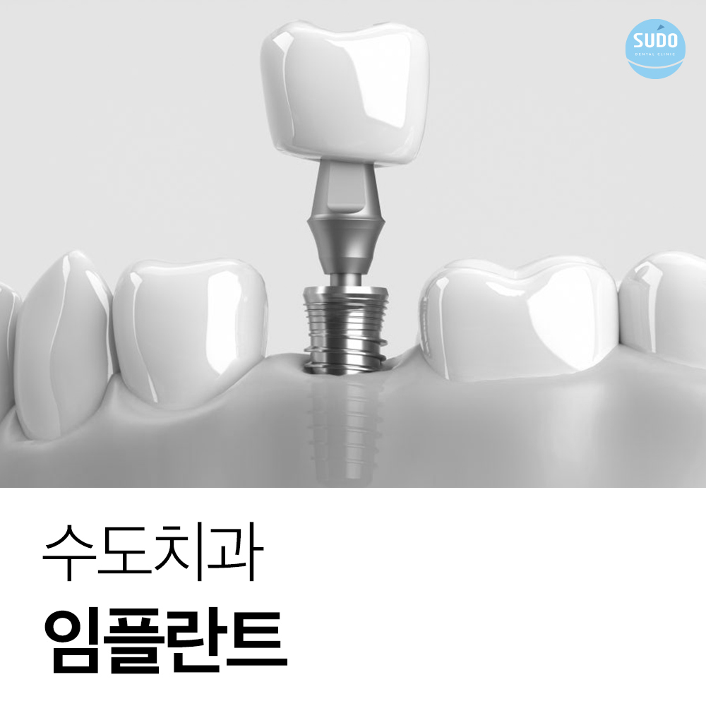 수도치과 임플란트