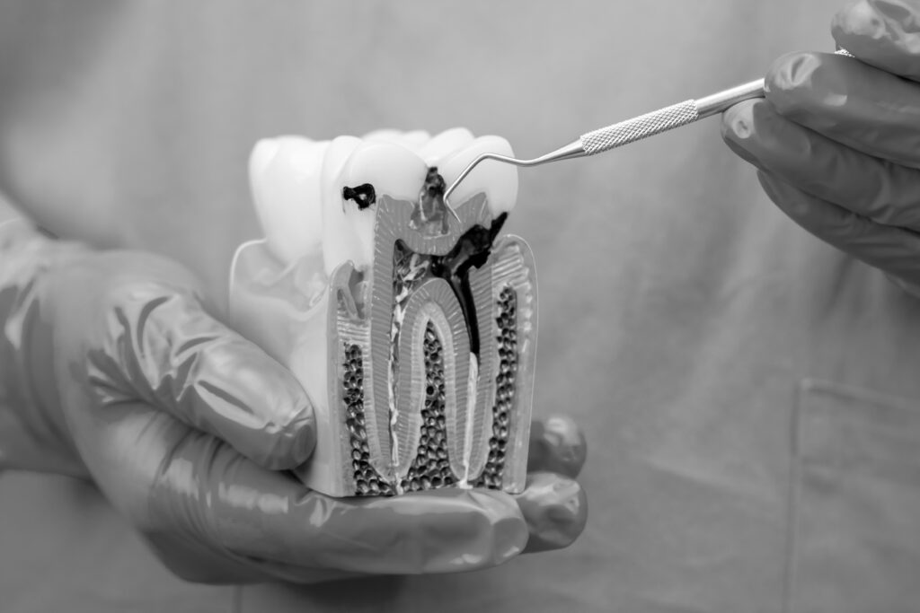 수도치과 충치치료