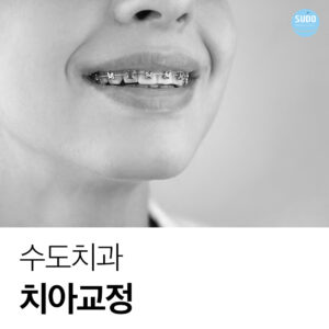 수도치과 치아교정