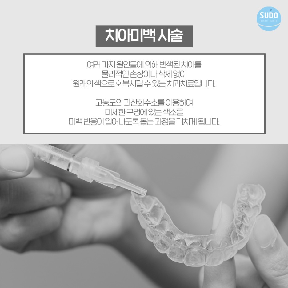 수도치과 치아미백