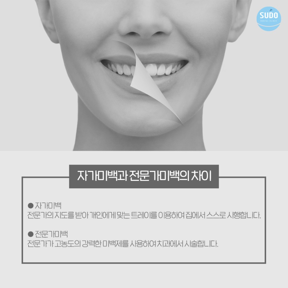 수도치과 치아미백