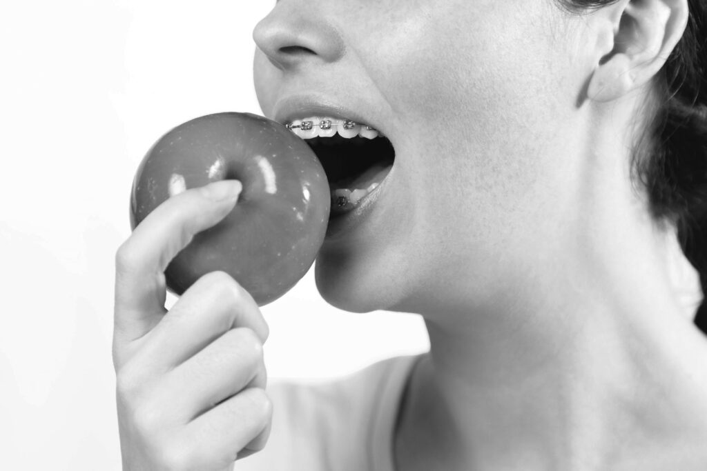 수도치과 치아교정