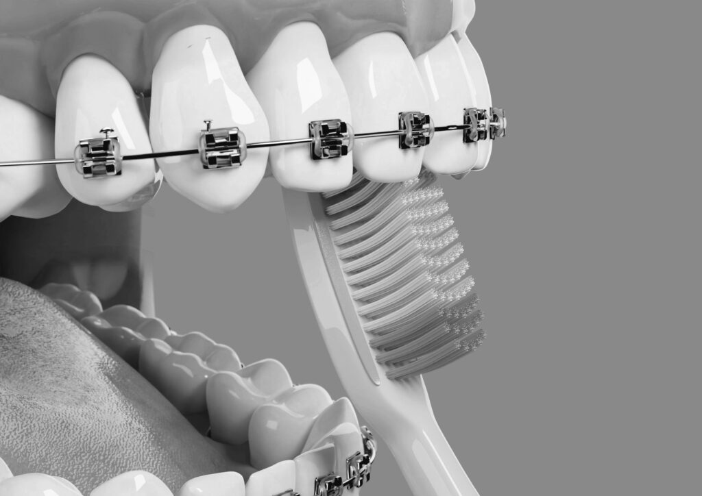 수도치과 치아교정