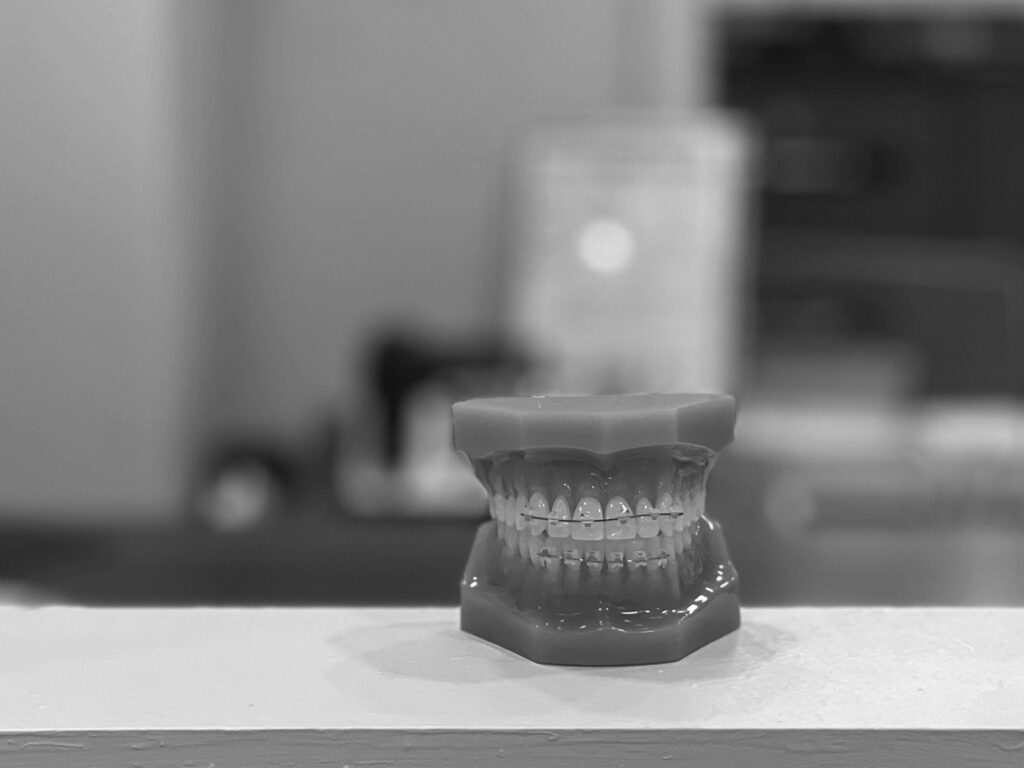 수도치과 치아교정