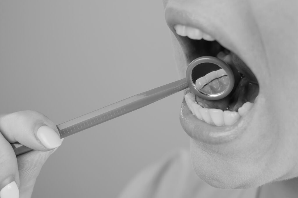 수도치과 치아교정