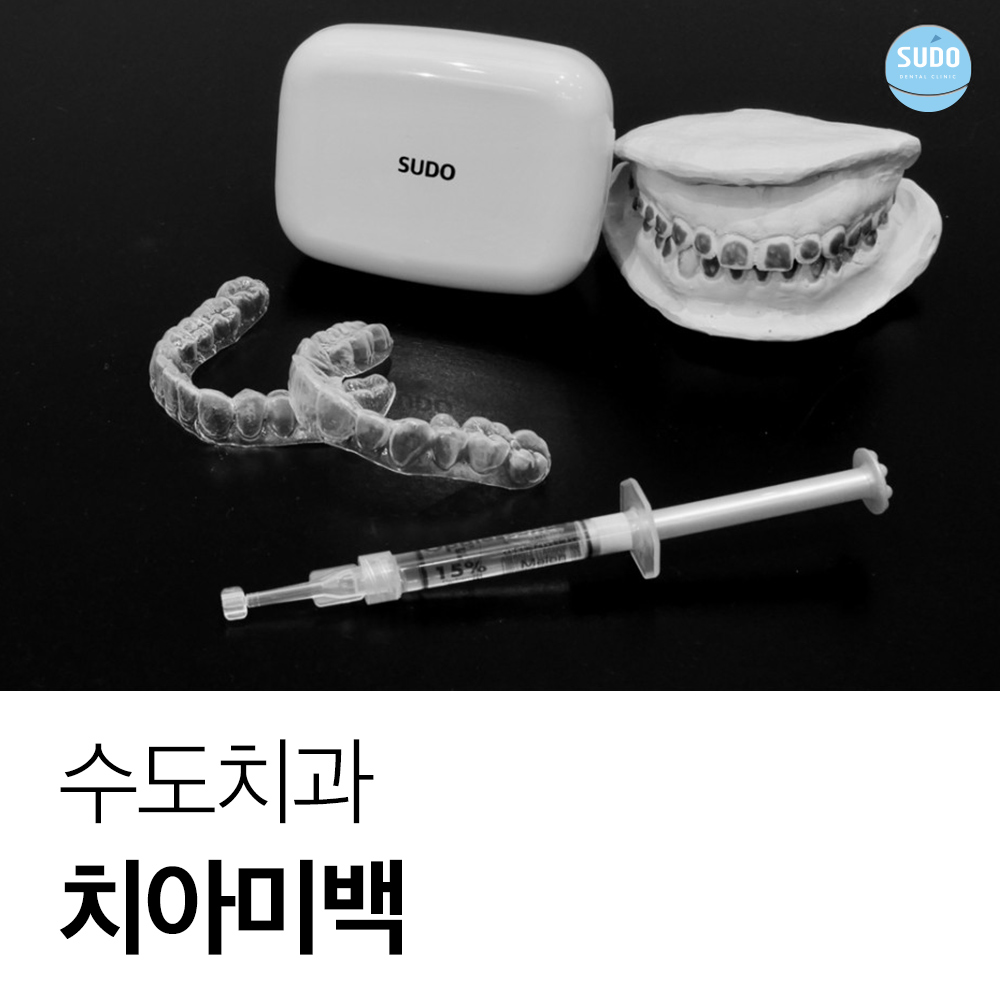 수도치과 치아미백