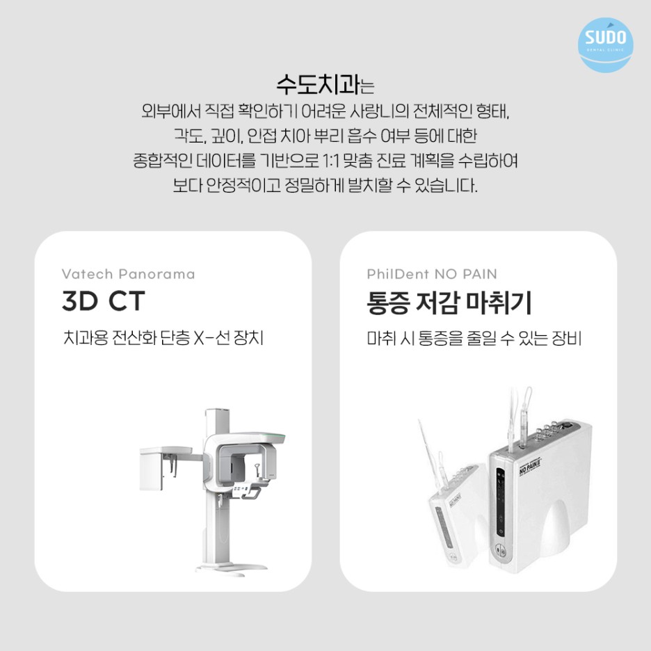 수도치과 사랑니발치 후 충치치료