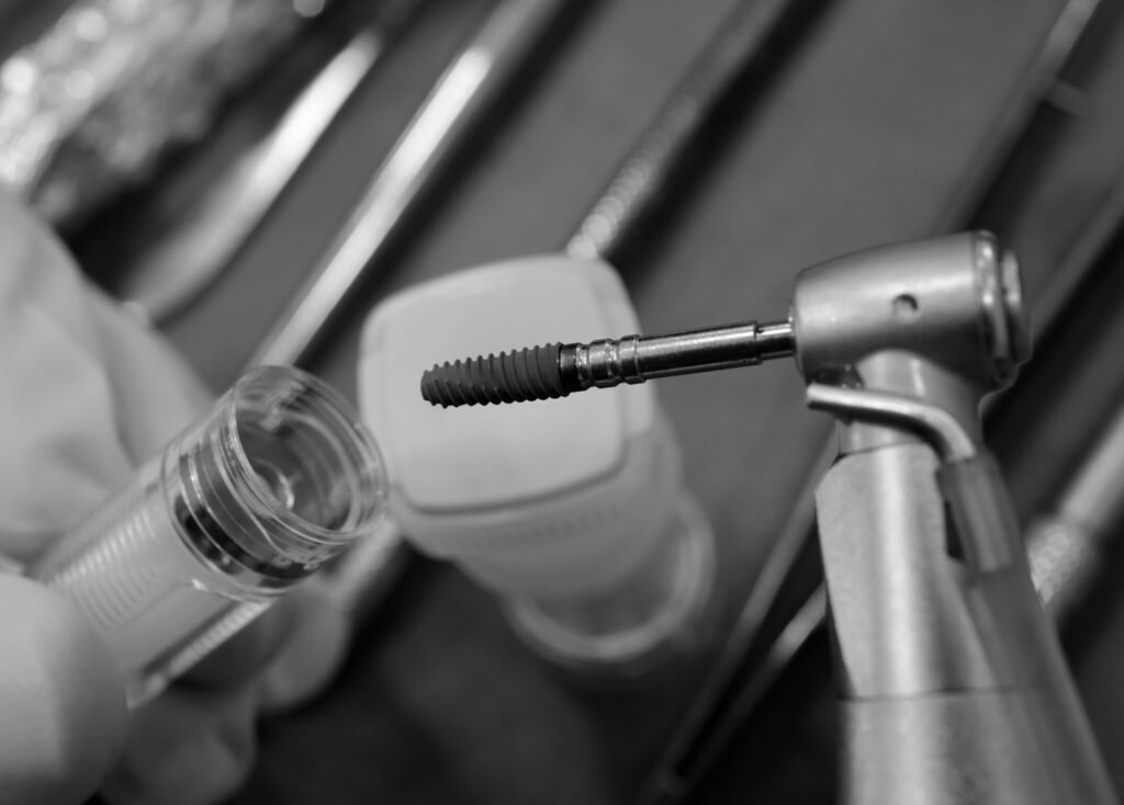 수도치과 임플란트