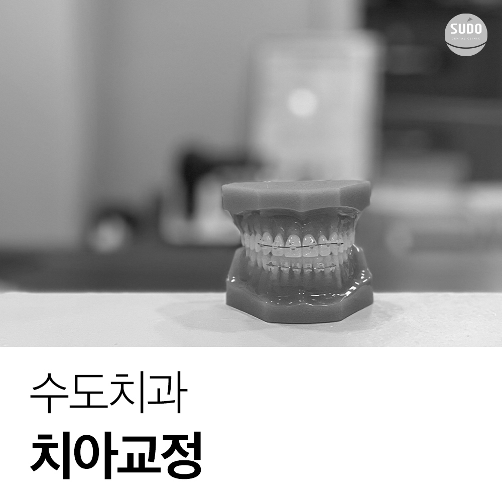 수도치과 치아교정