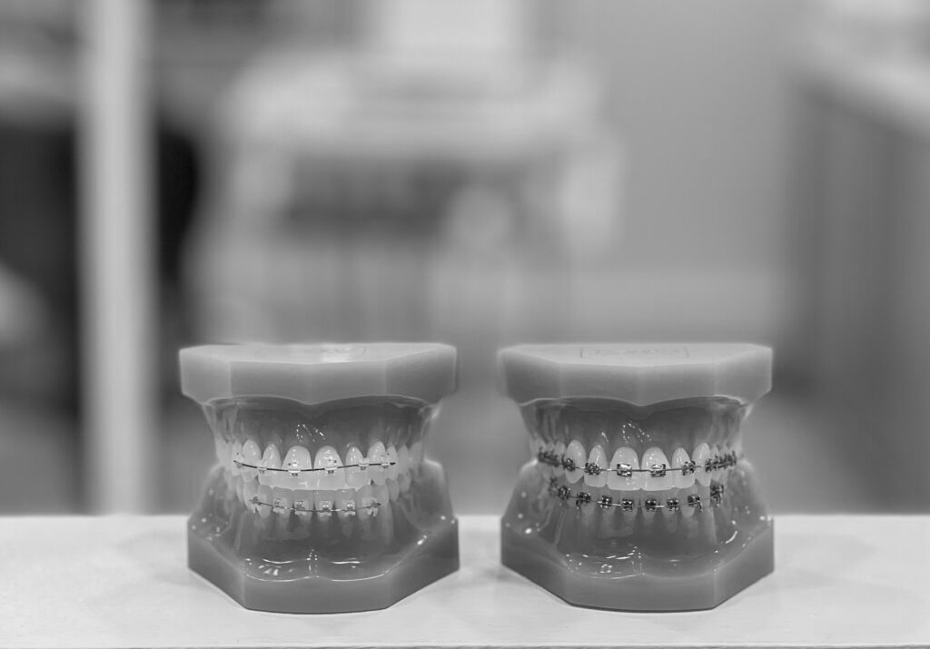 수도치과 치아교정