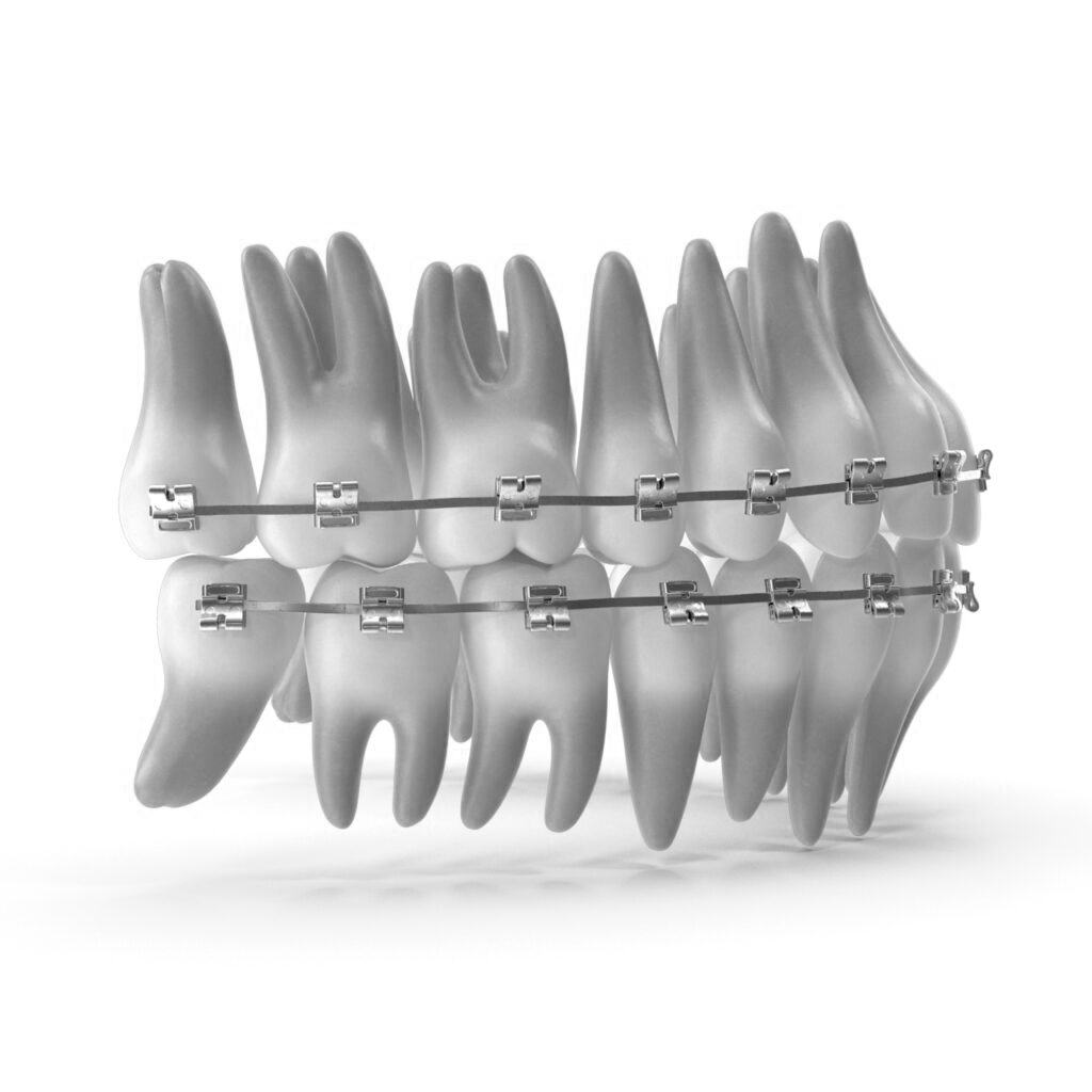 수도치과 치아교정