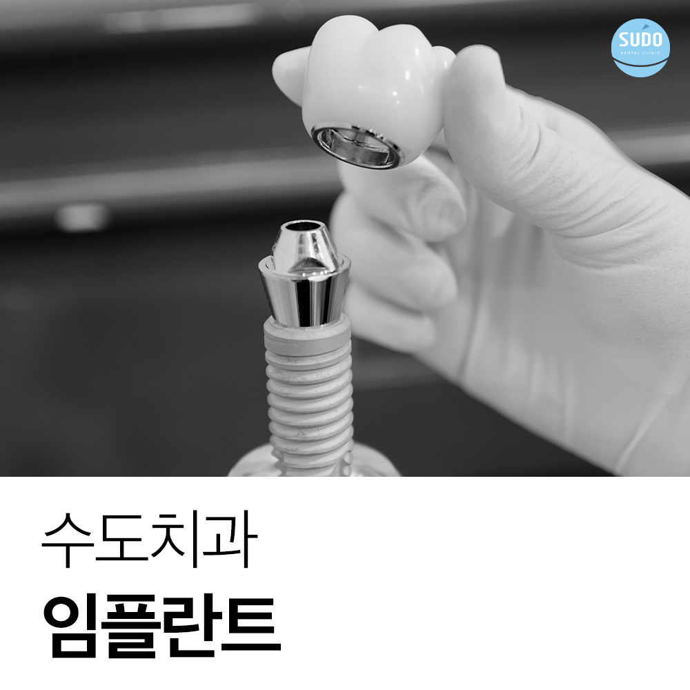 수도치과 임플란트