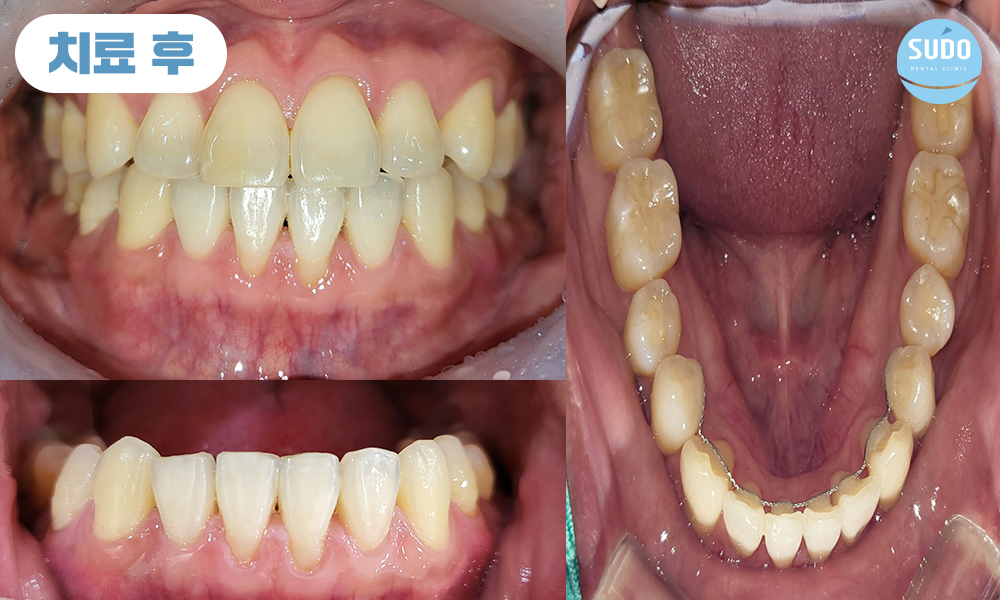 수도치과 치아교정