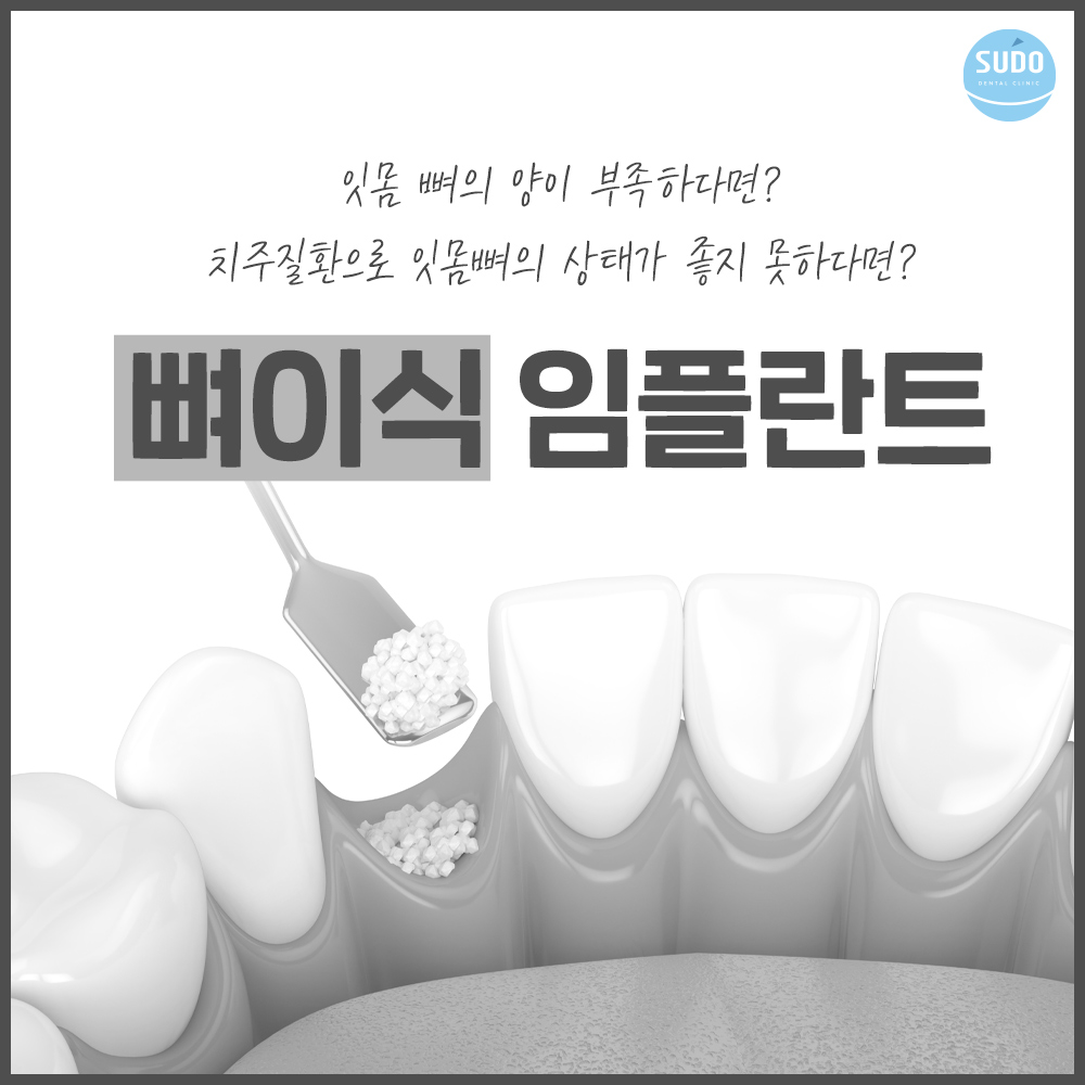 부산영도임플란트